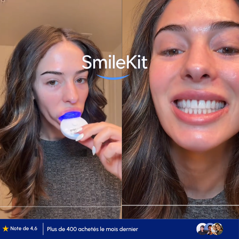 Le kit de blanchiment SmileKit qui révèle votre plus beau sourire